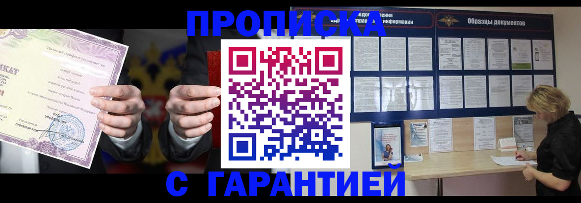 временная регистрация гарантия в Калуге